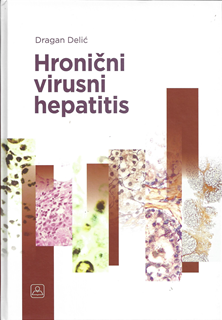upload202112171850373264.png Z36151 Hronični virusni hepatitis - Slika 1