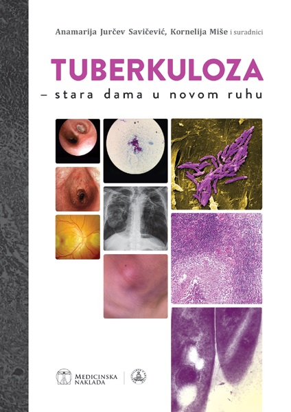 9789533680132 Tuberkuloza, stara dama u novom ruhu - Slika 1
