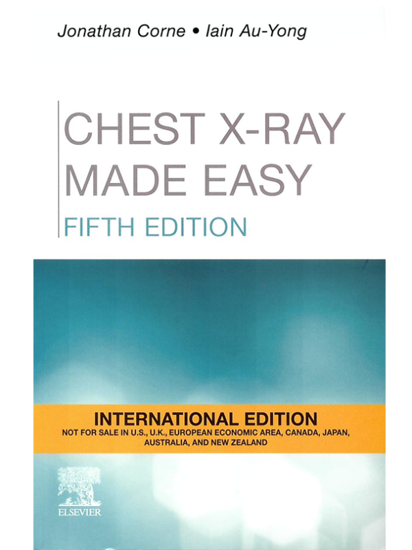9780702082351 Chest X-Ray Made Easy, 5th Edition, International Edition - Slika 1